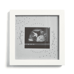 Image showing the Forever Treasured Baby Scan Frame, White product.